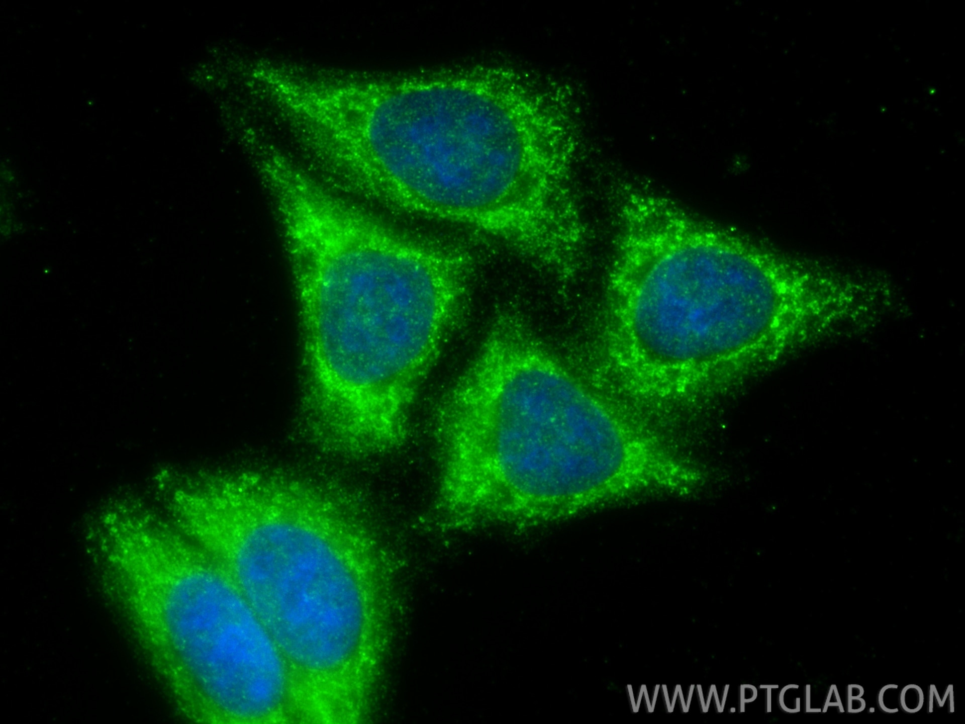 Immunofluorescence (IF) / fluorescent staining of HepG2 cells using SMAP2 Polyclonal antibody (16597-1-AP)
