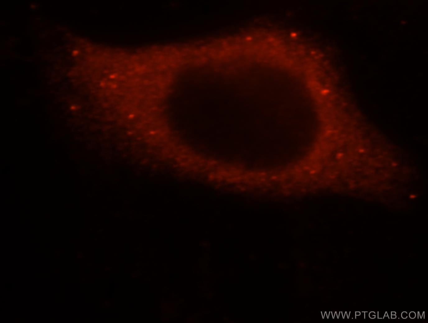 Immunofluorescence (IF) / fluorescent staining of HepG2 cells using SMAP2 Polyclonal antibody (16597-1-AP)