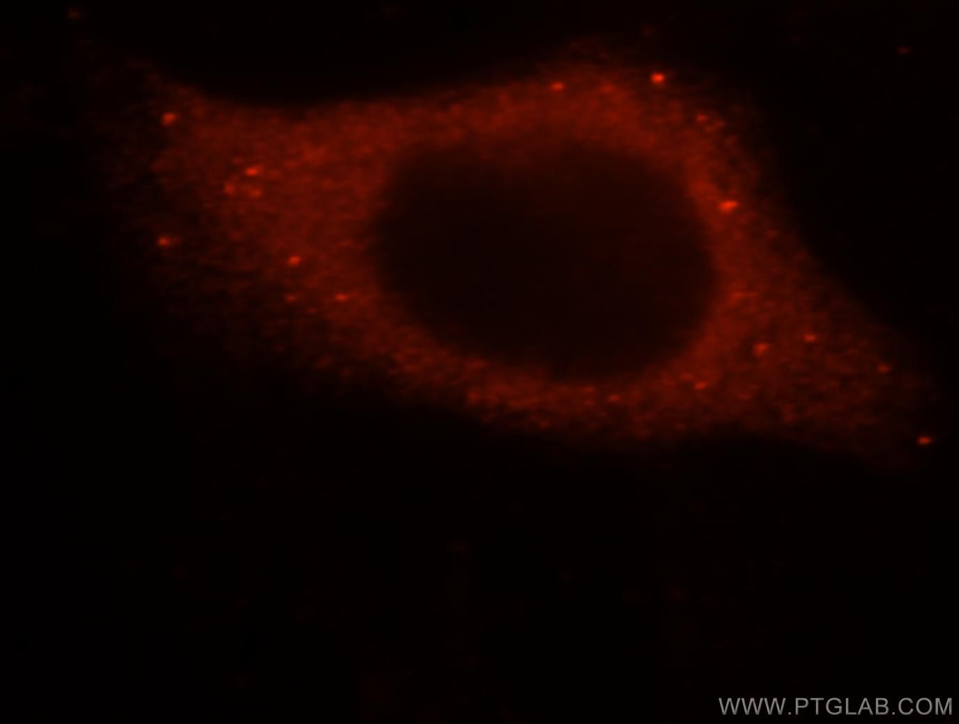 IF Staining of HepG2 using 16597-1-AP