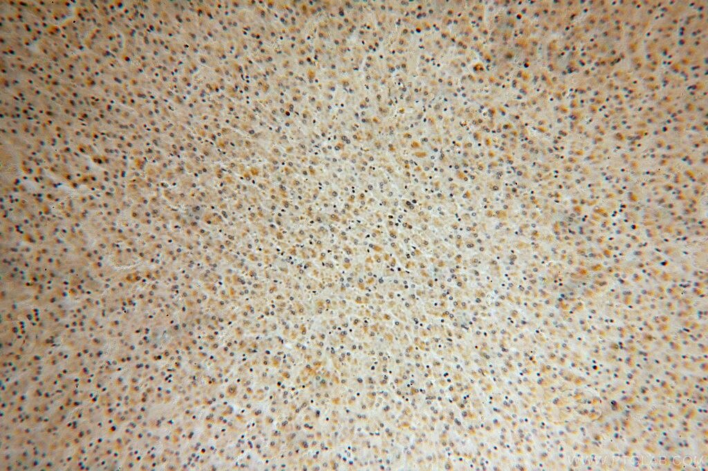 Immunohistochemistry (IHC) staining of human liver tissue using SMAP2 Polyclonal antibody (16597-1-AP)