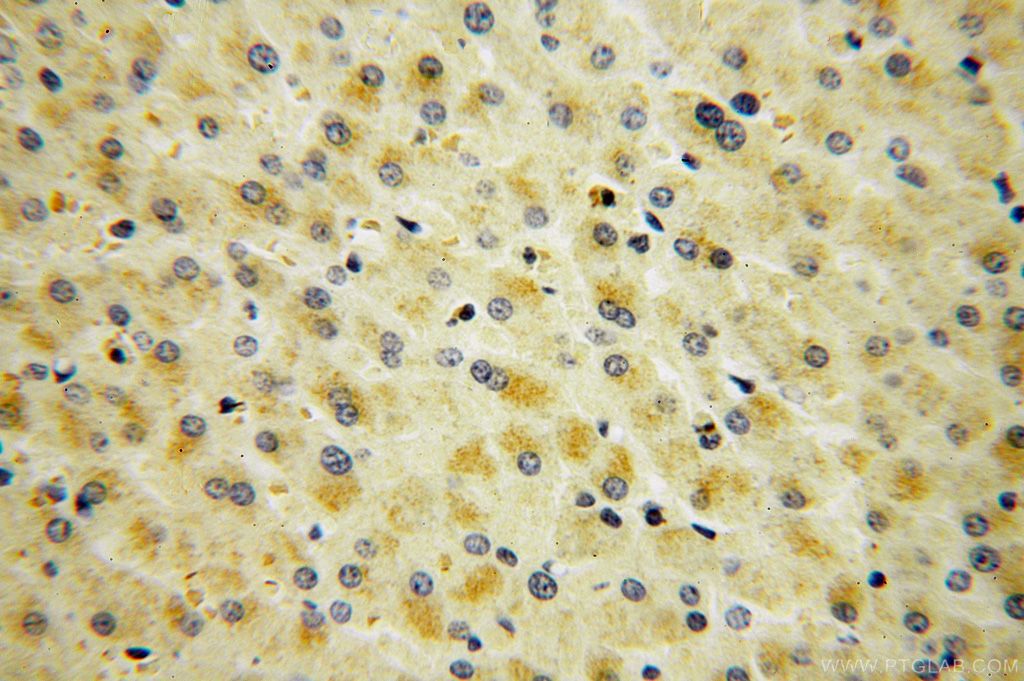 Immunohistochemistry (IHC) staining of human liver tissue using SMAP2 Polyclonal antibody (16597-1-AP)