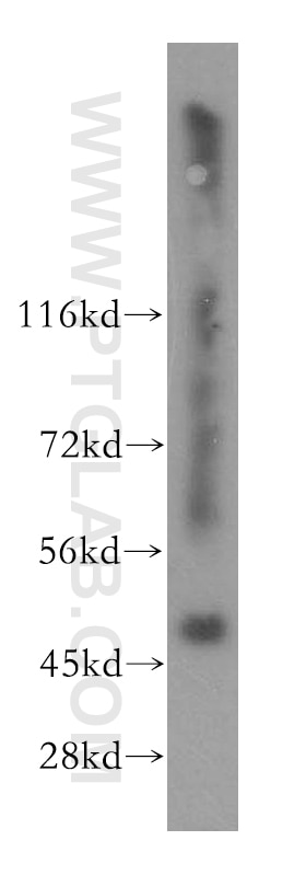 Western Blot (WB) analysis of mouse small intestine tissue using SMAP2 Polyclonal antibody (16597-1-AP)