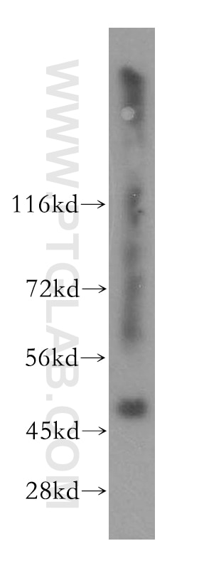 WB analysis of mouse small intestine using 16597-1-AP