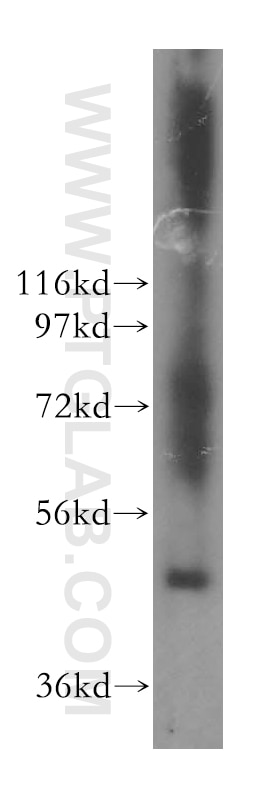 Western Blot (WB) analysis of human colon tissue using SMAP2 Polyclonal antibody (16597-1-AP)