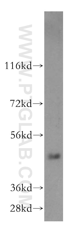 Western Blot (WB) analysis of human liver tissue using SMAP2 Polyclonal antibody (16597-1-AP)