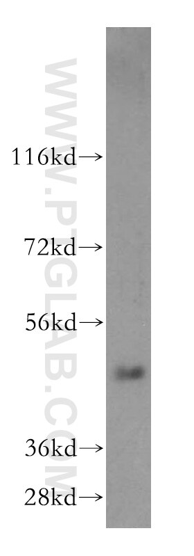 WB analysis of human liver using 16597-1-AP