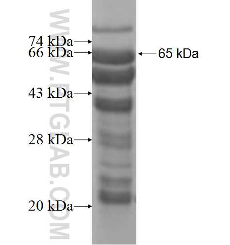 SMAP2 fusion protein Ag9751 SDS-PAGE