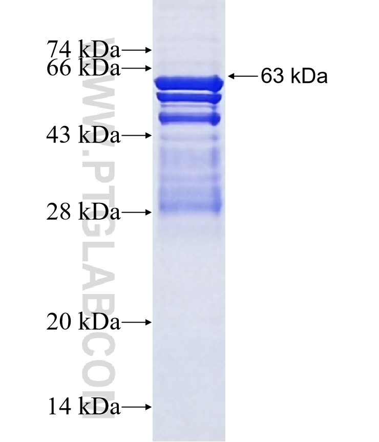 SMAP2 fusion protein Ag9751 SDS-PAGE