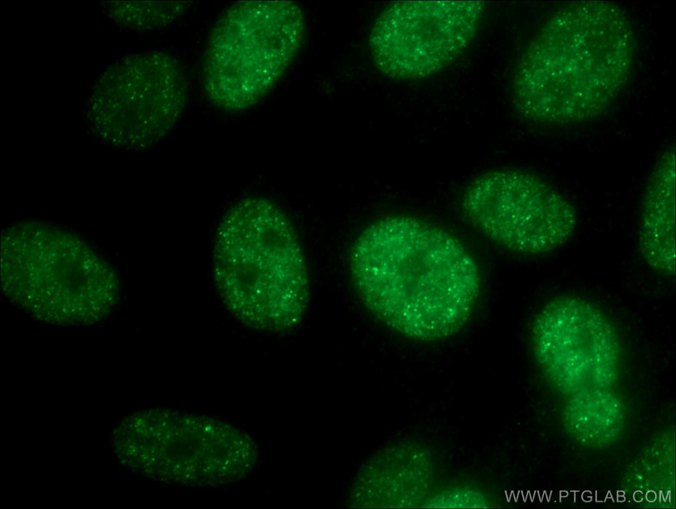 Immunofluorescence (IF) / fluorescent staining of HepG2 cells using SMARCA2-Specific Polyclonal antibody (26613-1-AP)