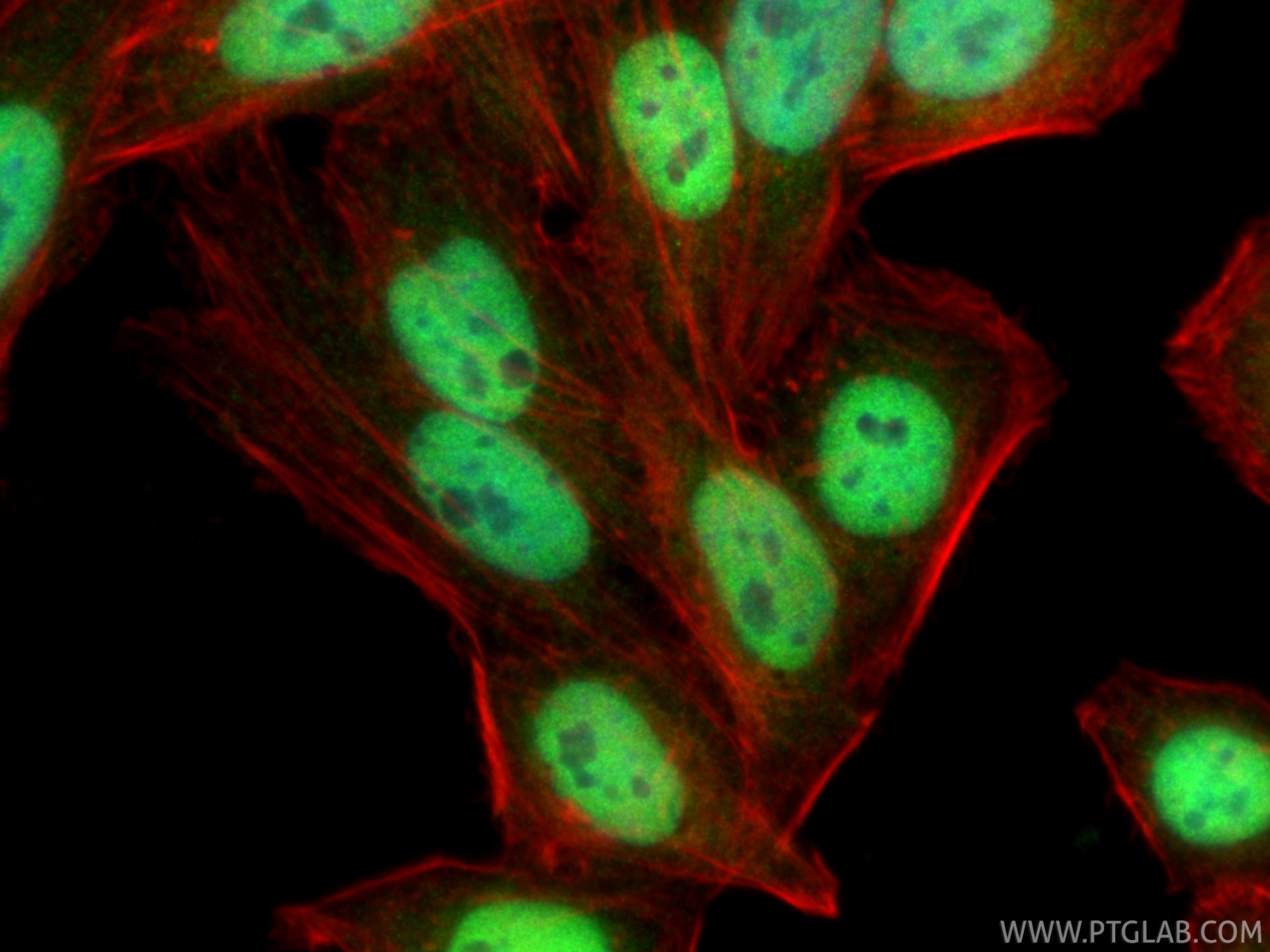 Immunofluorescence (IF) / fluorescent staining of HepG2 cells using BRM/SMARCA2-Specific Polyclonal antibody (26613-1-AP)