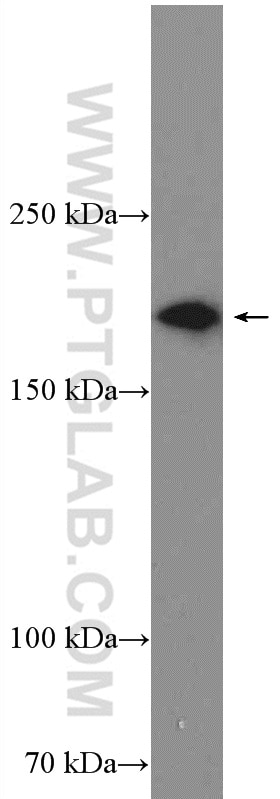 Western Blot (WB) analysis of NIH/3T3 cells using SMARCA2-Specific Polyclonal antibody (26613-1-AP)