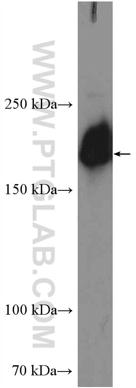 Western Blot (WB) analysis of MDA-MB-453s cells using SMARCA2-Specific Polyclonal antibody (26613-1-AP)