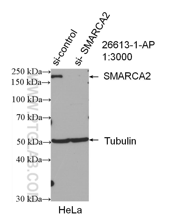 Western Blot (WB) analysis of HeLa cells using SMARCA2-Specific Polyclonal antibody (26613-1-AP)