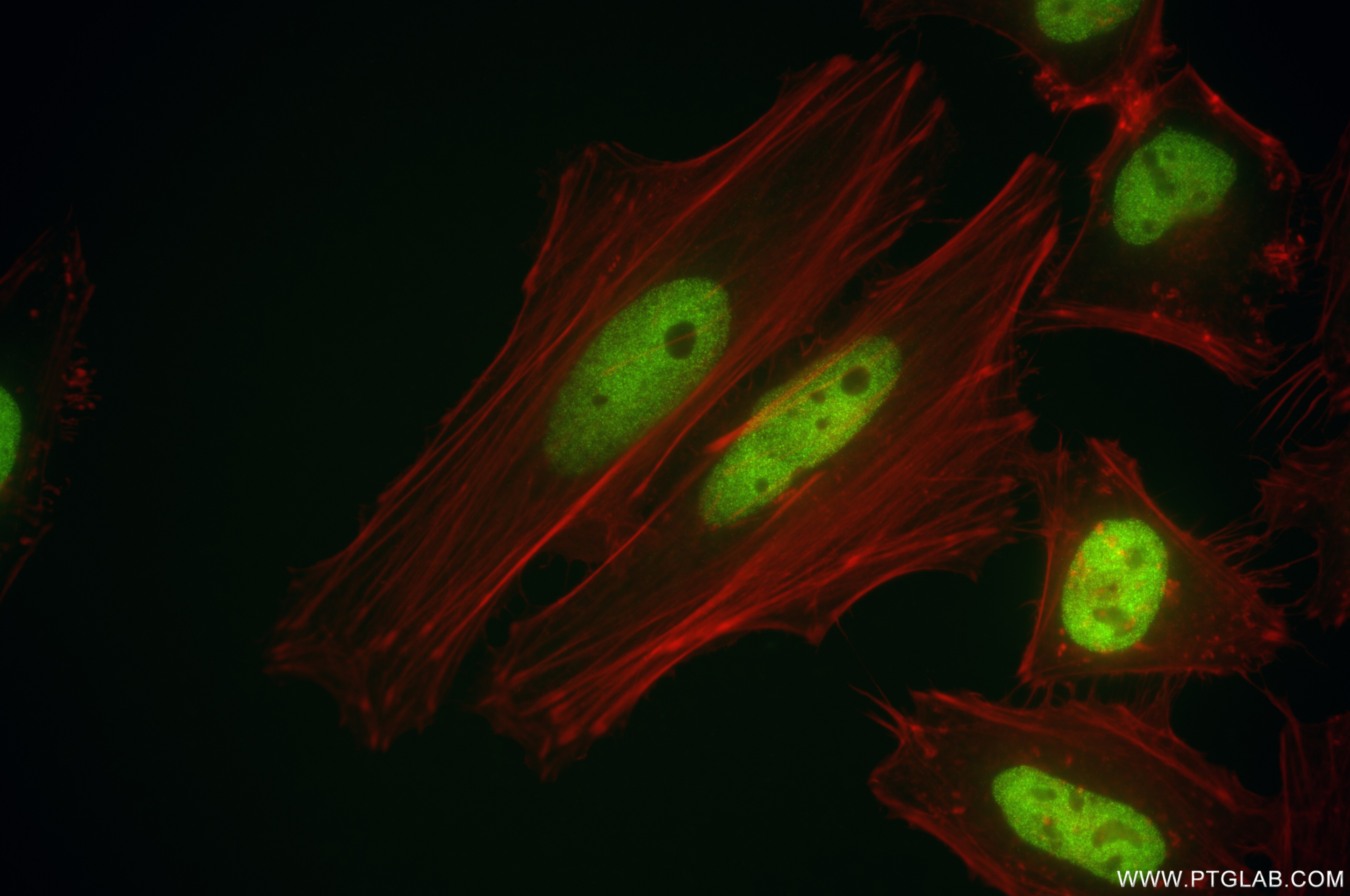 Immunofluorescence (IF) / fluorescent staining of HeLa cells using SMARCA2-Specific Recombinant antibody (85018-4-RR)