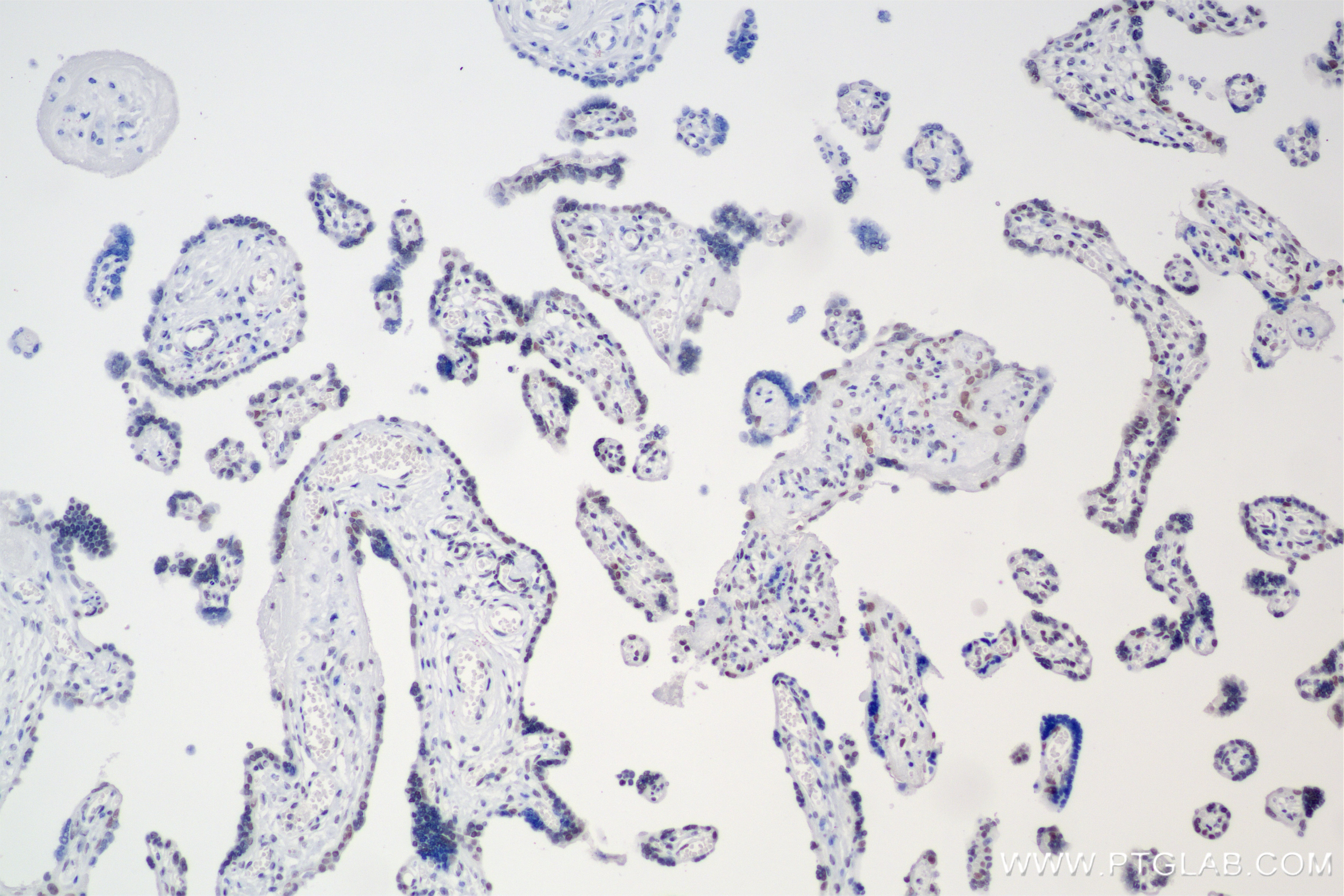 Immunohistochemistry (IHC) staining of human placenta tissue using SMARCA2-Specific Recombinant antibody (85018-4-RR)
