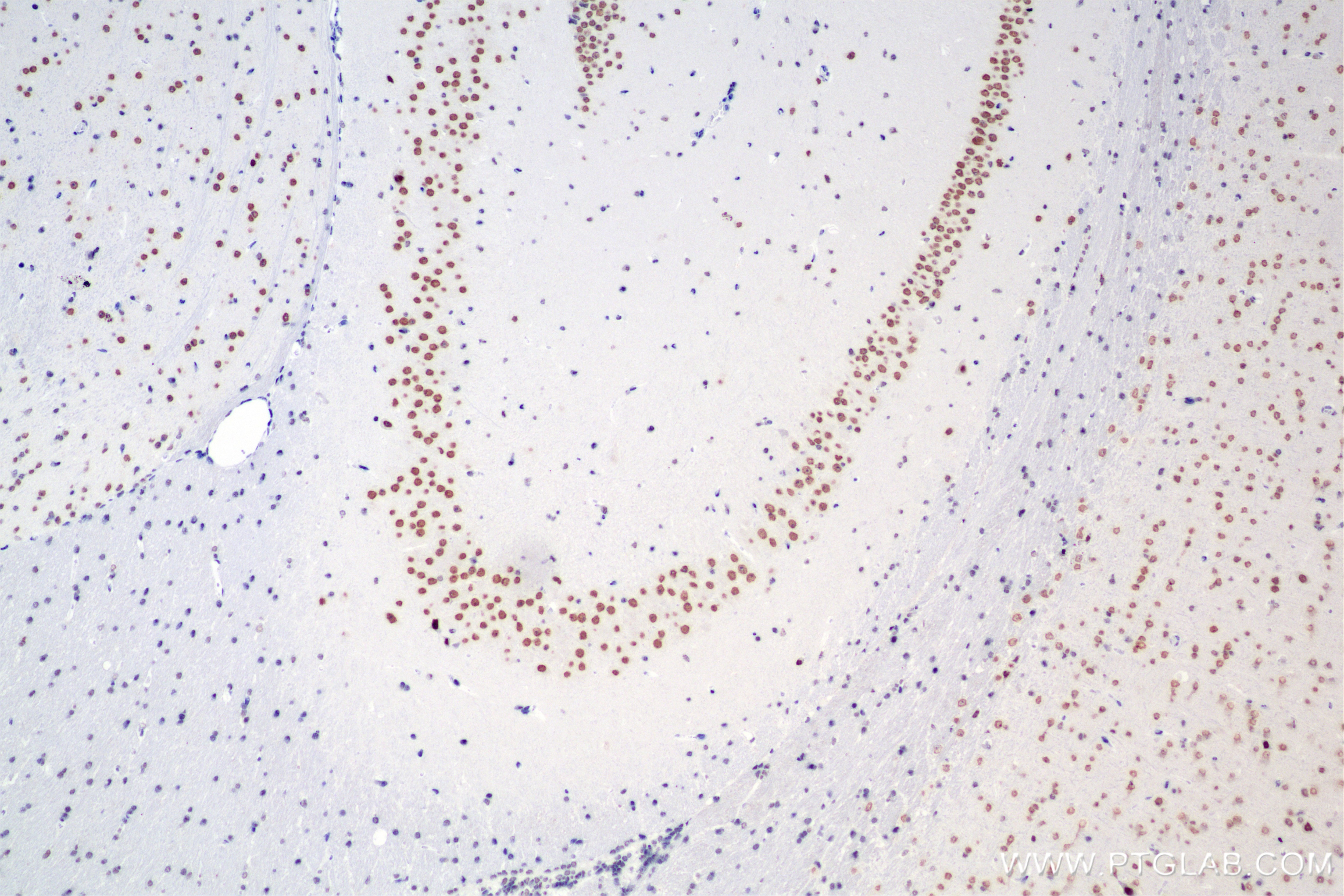 Immunohistochemistry (IHC) staining of mouse brain tissue using SMARCA2-Specific Recombinant antibody (85018-4-RR)