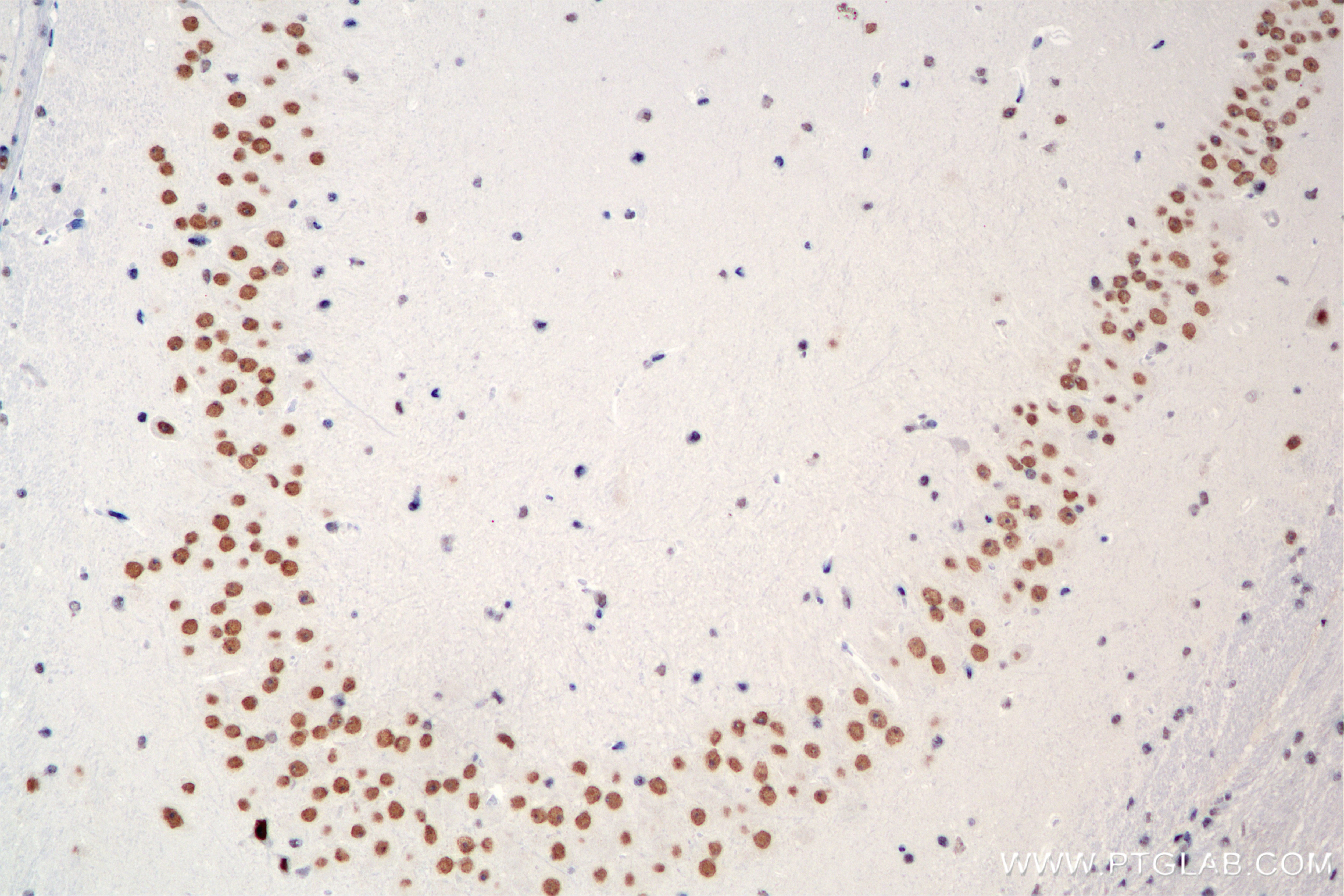 Immunohistochemistry (IHC) staining of mouse brain tissue using SMARCA2-Specific Recombinant antibody (85018-4-RR)