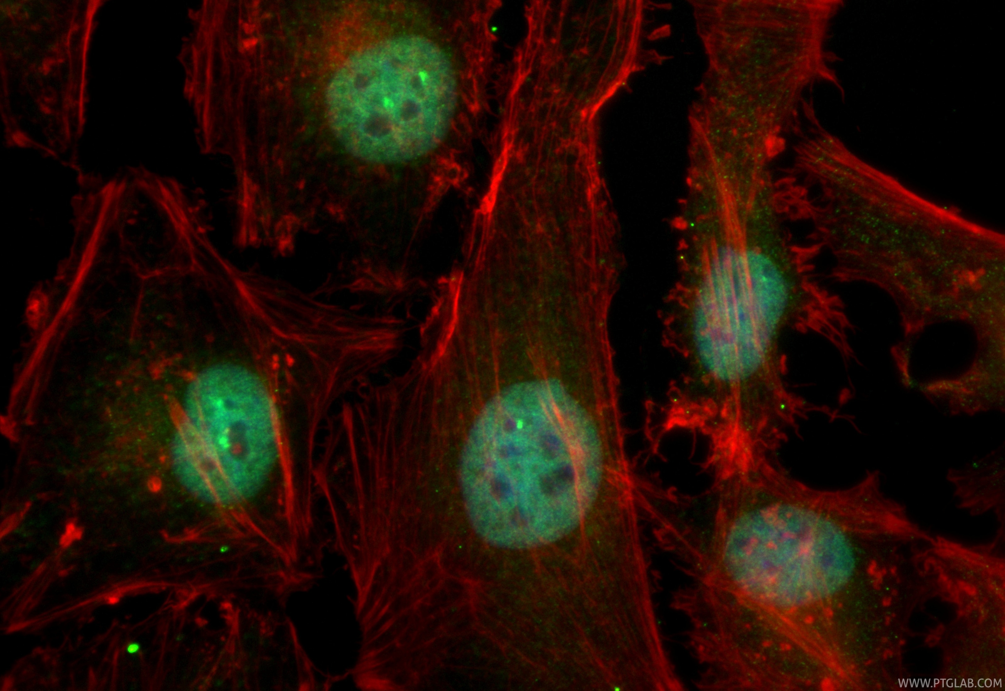 Immunofluorescence (IF) / fluorescent staining of HeLa cells using CoraLite® Plus 488-conjugated SMARCA2-Specific Rec (CL488-85018-4)