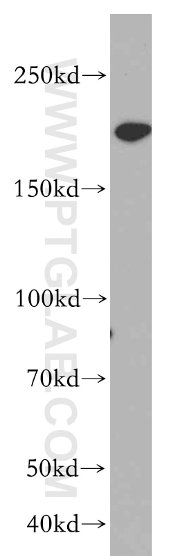 Western Blot (WB) analysis of HeLa cells using SMARCA4/BRG1 Polyclonal antibody (20650-1-AP)