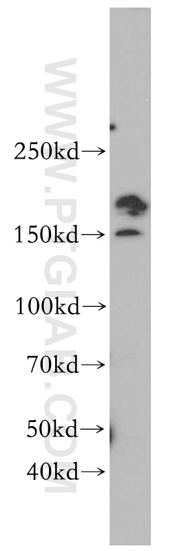 Western Blot (WB) analysis of K-562 cells using SMARCA4/BRG1 Polyclonal antibody (20650-1-AP)