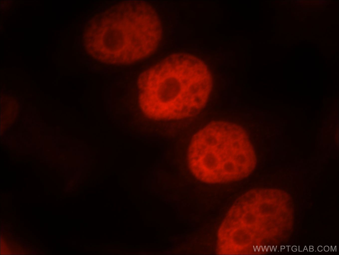 Immunofluorescence (IF) / fluorescent staining of HeLa cells using SMARCA4/BRG1 Polyclonal antibody (21634-1-AP)