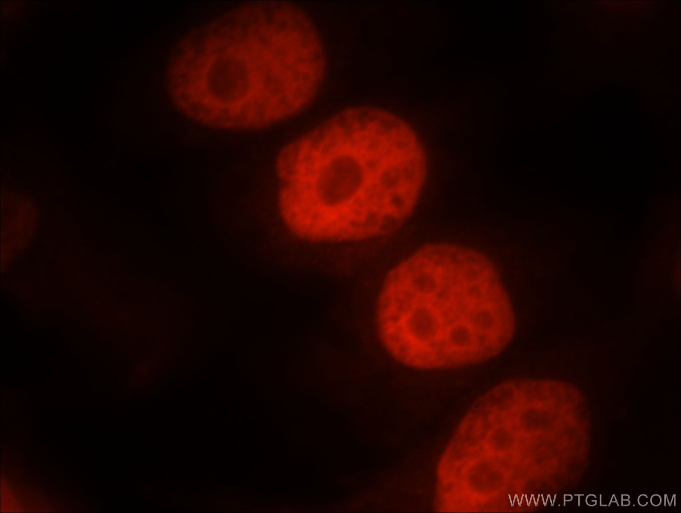 IF Staining of HeLa using 21634-1-AP