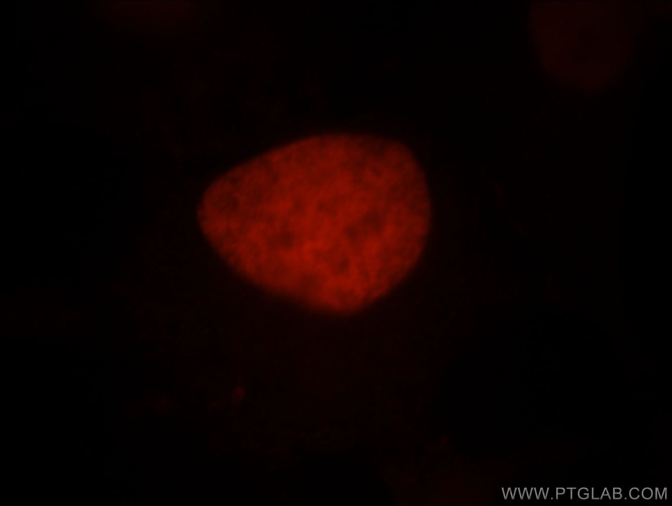 Immunofluorescence (IF) / fluorescent staining of HEK-293 cells using SMARCA4/BRG1 Polyclonal antibody (21634-1-AP)