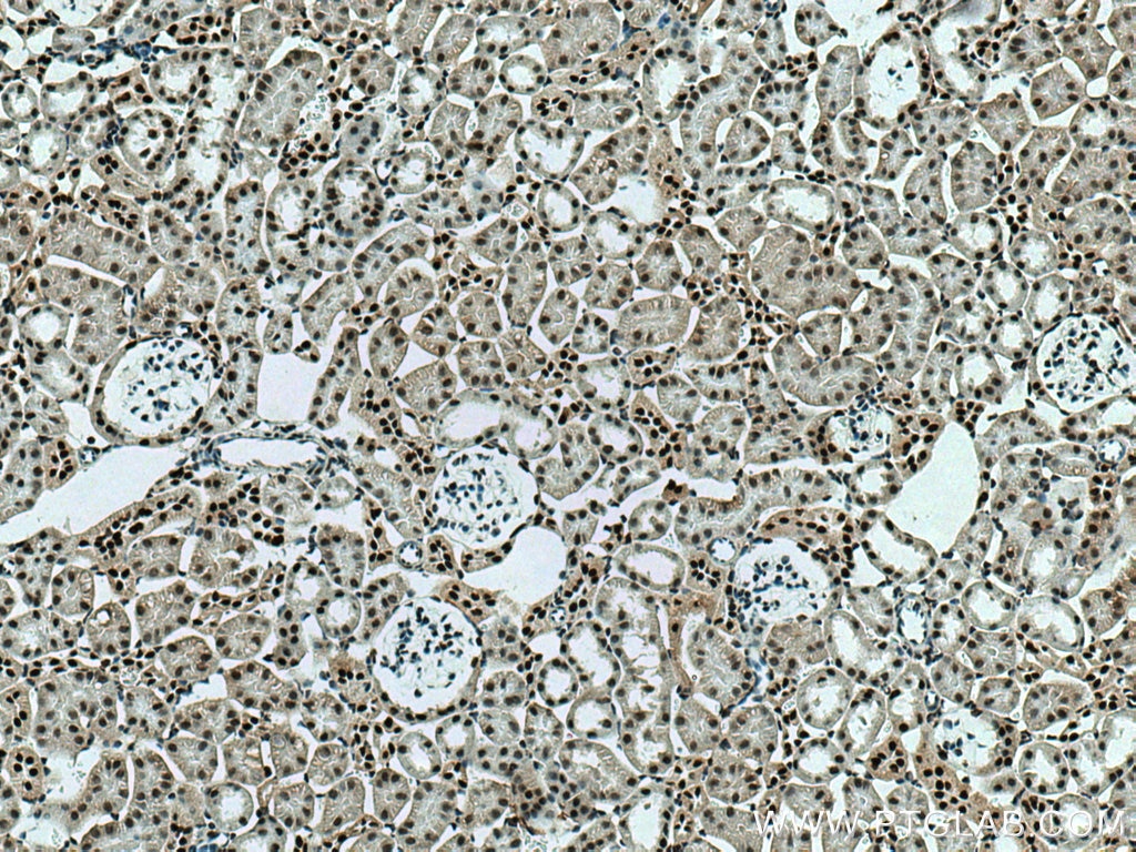 Immunohistochemistry (IHC) staining of mouse kidney tissue using SMARCA4/BRG1 Polyclonal antibody (21634-1-AP)