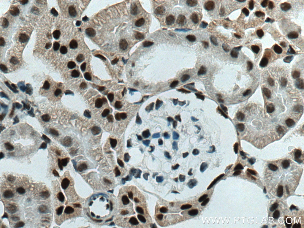 Immunohistochemistry (IHC) staining of mouse kidney tissue using SMARCA4/BRG1 Polyclonal antibody (21634-1-AP)