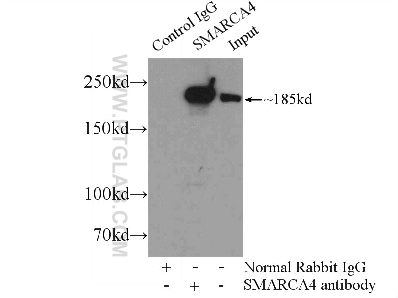 Immunoprecipitation (IP) experiment of HeLa cells using SMARCA4/BRG1 Polyclonal antibody (21634-1-AP)