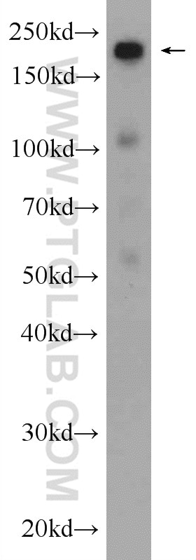 Western Blot (WB) analysis of mouse brain tissue using SMARCA4/BRG1 Polyclonal antibody (21634-1-AP)