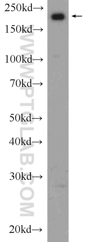 WB analysis of rat brain using 21634-1-AP