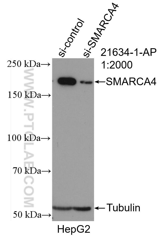 Western Blot (WB) analysis of HepG2 cells using SMARCA4/BRG1 Polyclonal antibody (21634-1-AP)