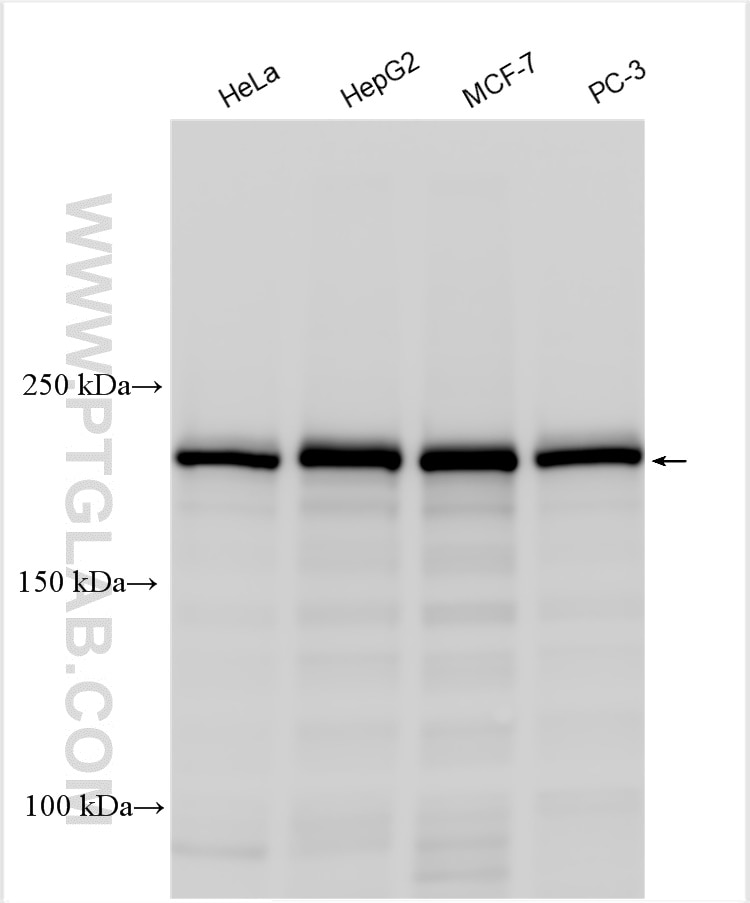 Western Blot (WB) analysis of various lysates using SMARCA4/BRG1 Polyclonal antibody (21634-1-AP)
