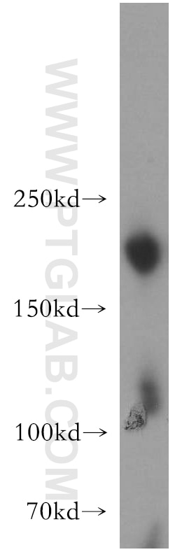 Western Blot (WB) analysis of human placenta tissue using SMARCA4/BRG1 Polyclonal antibody (21634-1-AP)