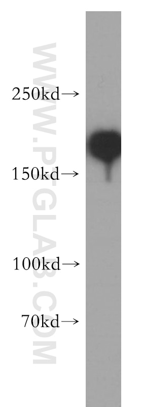 SMARCA4/BRG1 Polyclonal antibody