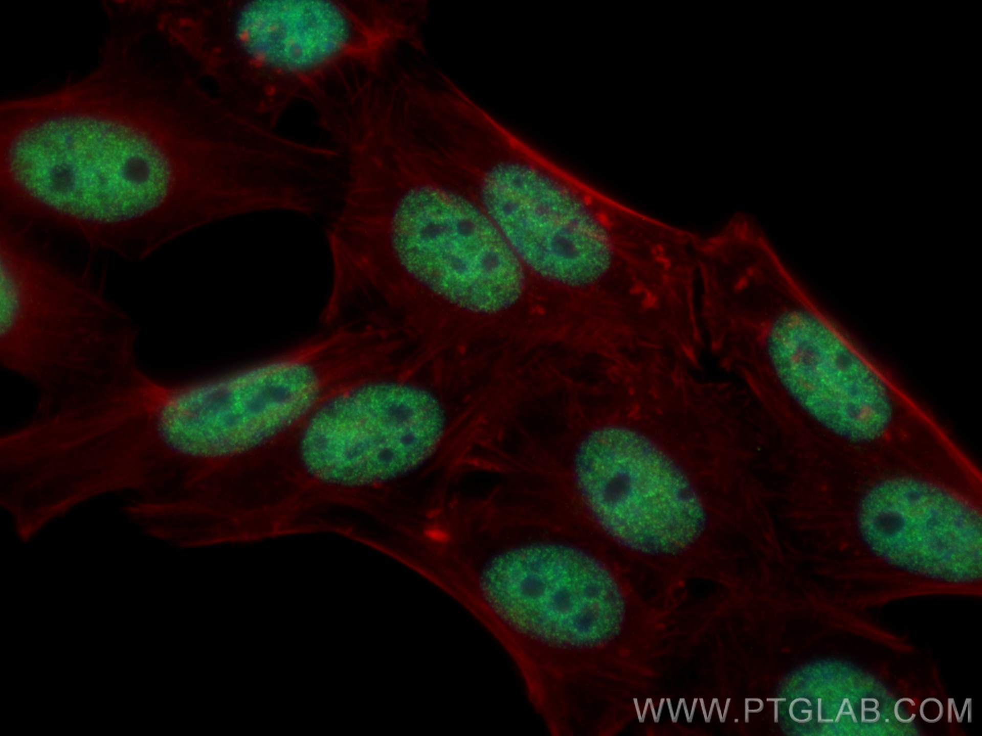Immunofluorescence (IF) / fluorescent staining of HepG2 cells using SMARCA4/BRG1 Monoclonal antibody (66561-1-Ig)