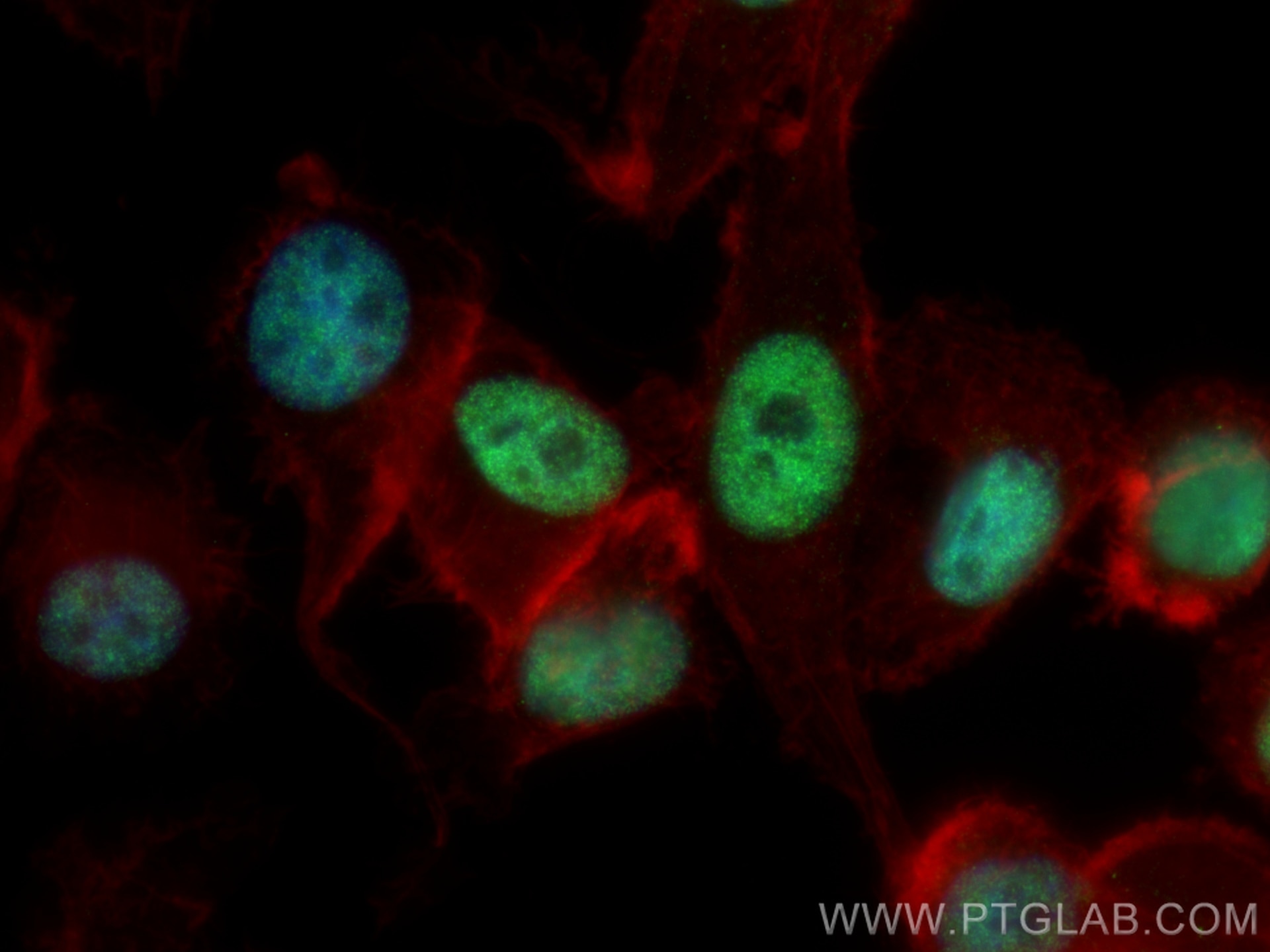 Immunofluorescence (IF) / fluorescent staining of PC-3 cells using SMARCA4/BRG1 Monoclonal antibody (66561-1-Ig)