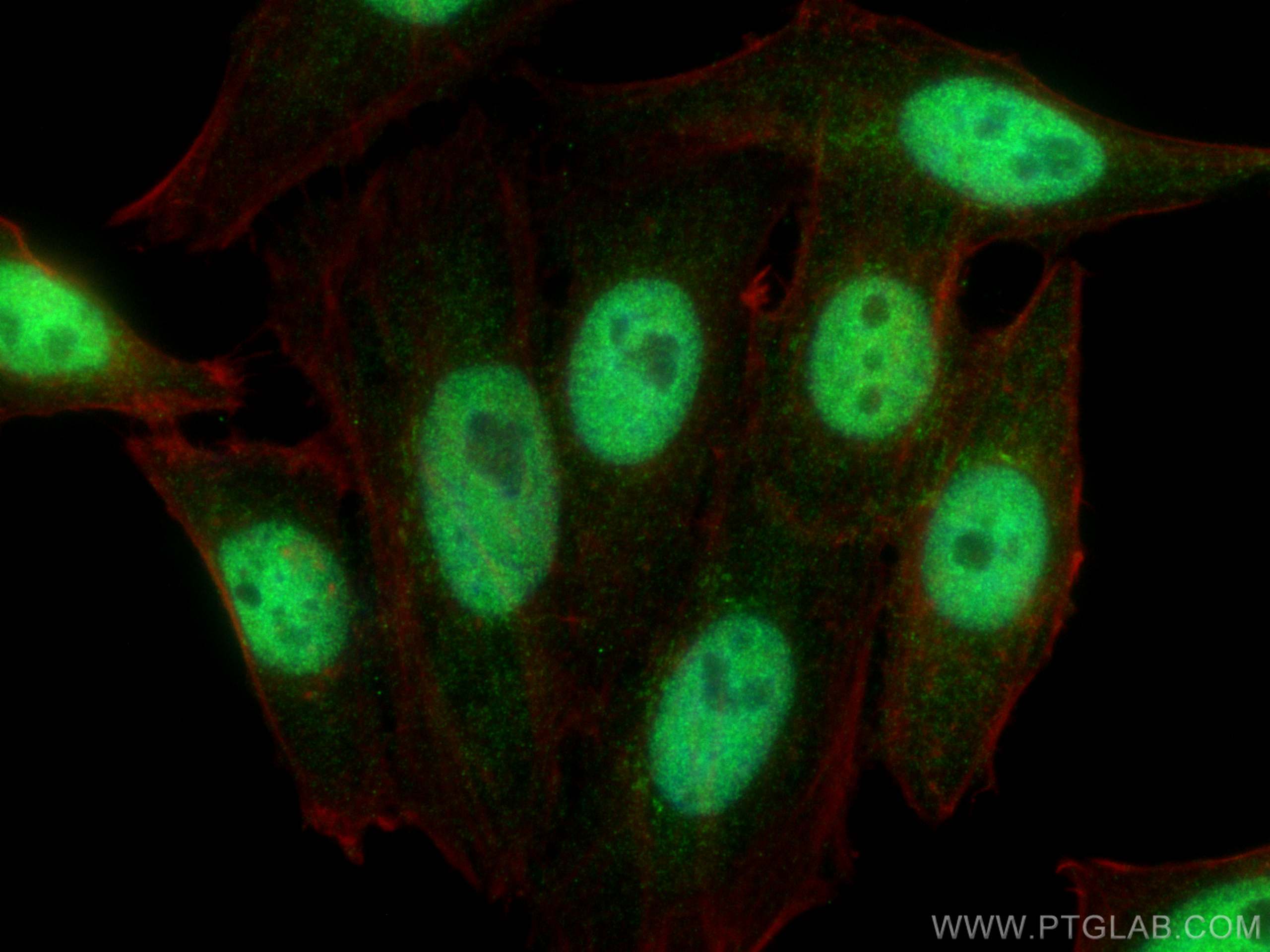 Immunofluorescence (IF) / fluorescent staining of HepG2 cells using SMARCA4/BRG1 Monoclonal antibody (66561-1-Ig)