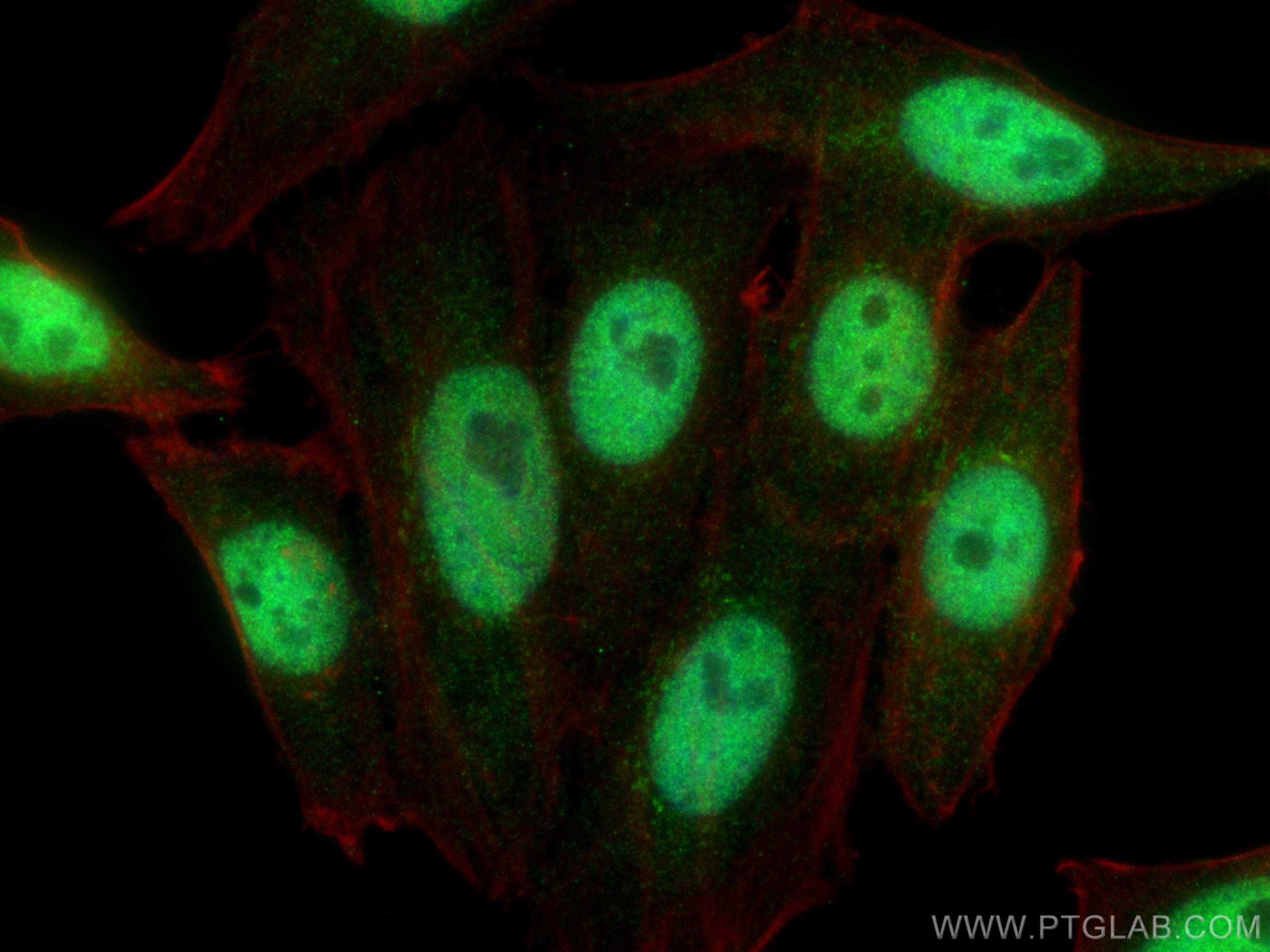 IF Staining of HepG2 using 66561-1-Ig