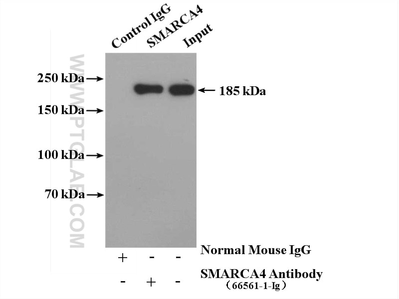 Immunoprecipitation (IP) experiment of HeLa cells using SMARCA4/BRG1 Monoclonal antibody (66561-1-Ig)
