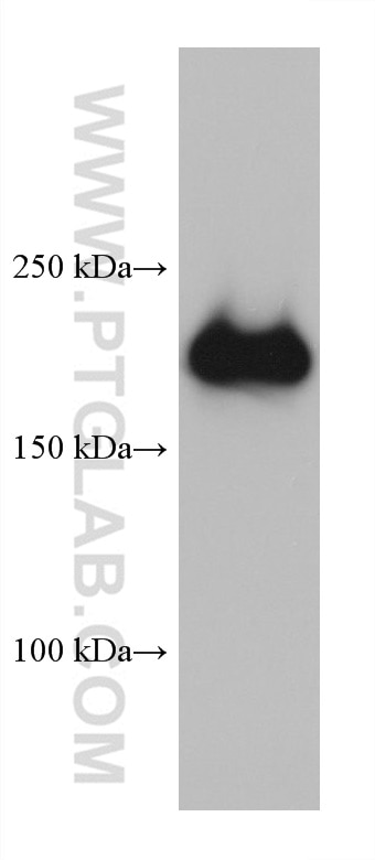 Western Blot (WB) analysis of COLO 320 cells using SMARCA4/BRG1 Monoclonal antibody (66561-1-Ig)