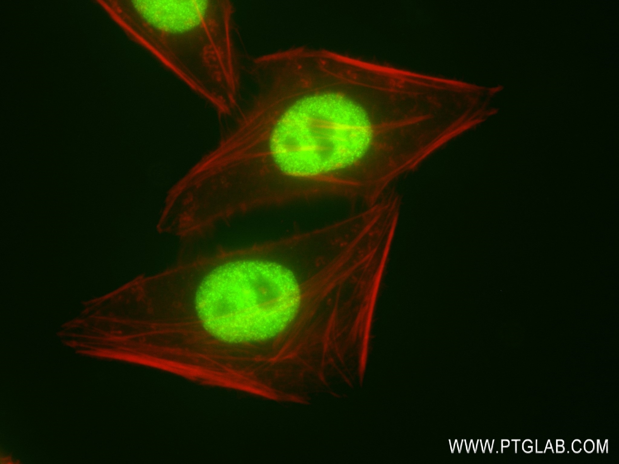 Immunofluorescence (IF) / fluorescent staining of HepG2 cells using SMARCA4 Recombinant antibody (83310-2-RR)