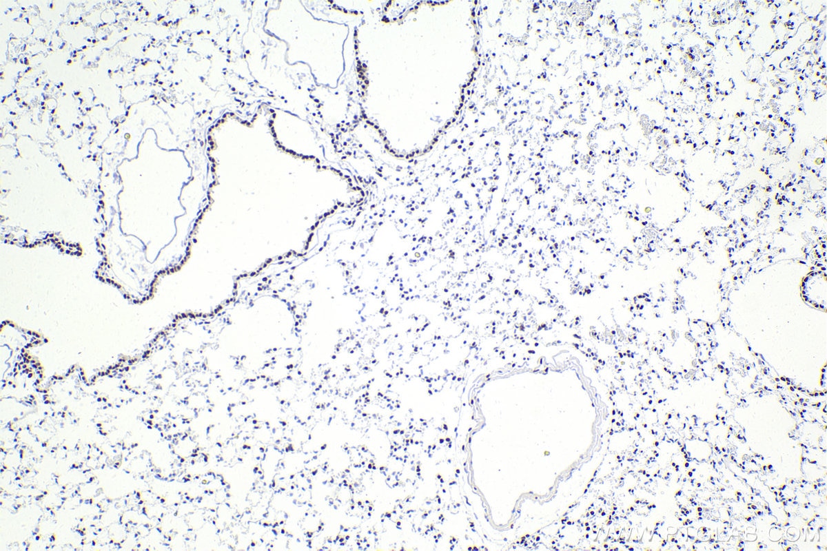 Immunohistochemistry (IHC) staining of mouse lung tissue using SMARCA4 Recombinant antibody (83310-2-RR)