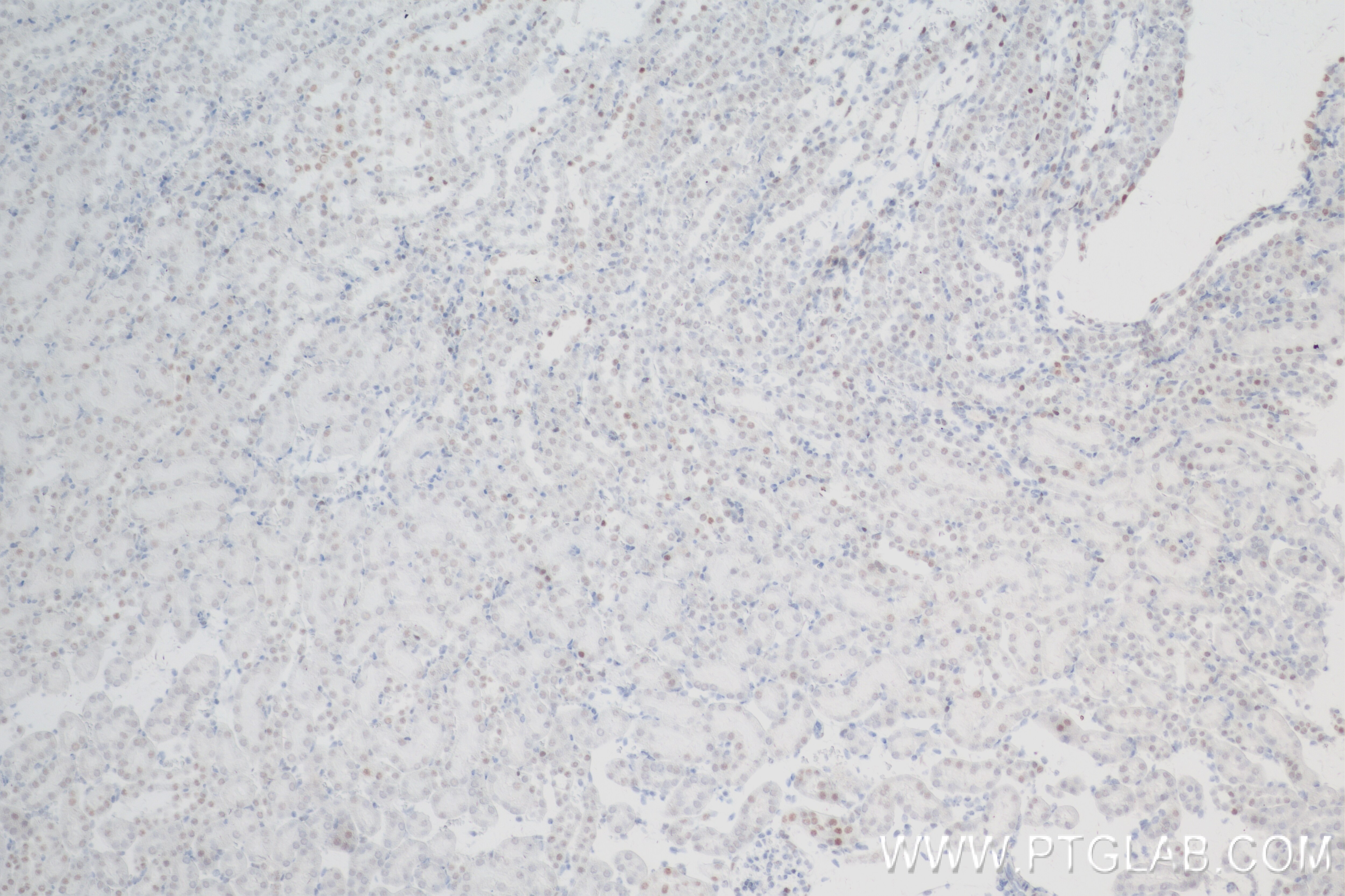 Immunohistochemistry (IHC) staining of mouse kidney tissue using SMARCA4 Recombinant antibody (83310-7-RR)