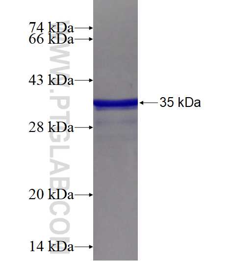 SMARCA4 fusion protein Ag16256 SDS-PAGE