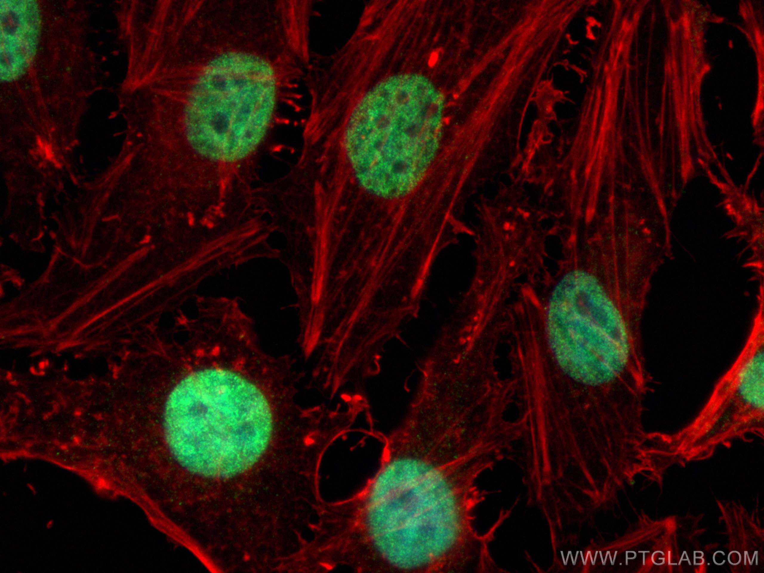 Immunofluorescence (IF) / fluorescent staining of HeLa cells using SMARCA5 Polyclonal antibody (13066-1-AP)
