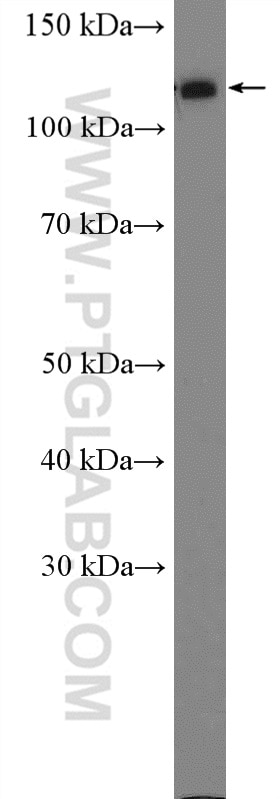 Western Blot (WB) analysis of HepG2 cells using SMARCA5 Polyclonal antibody (13066-1-AP)