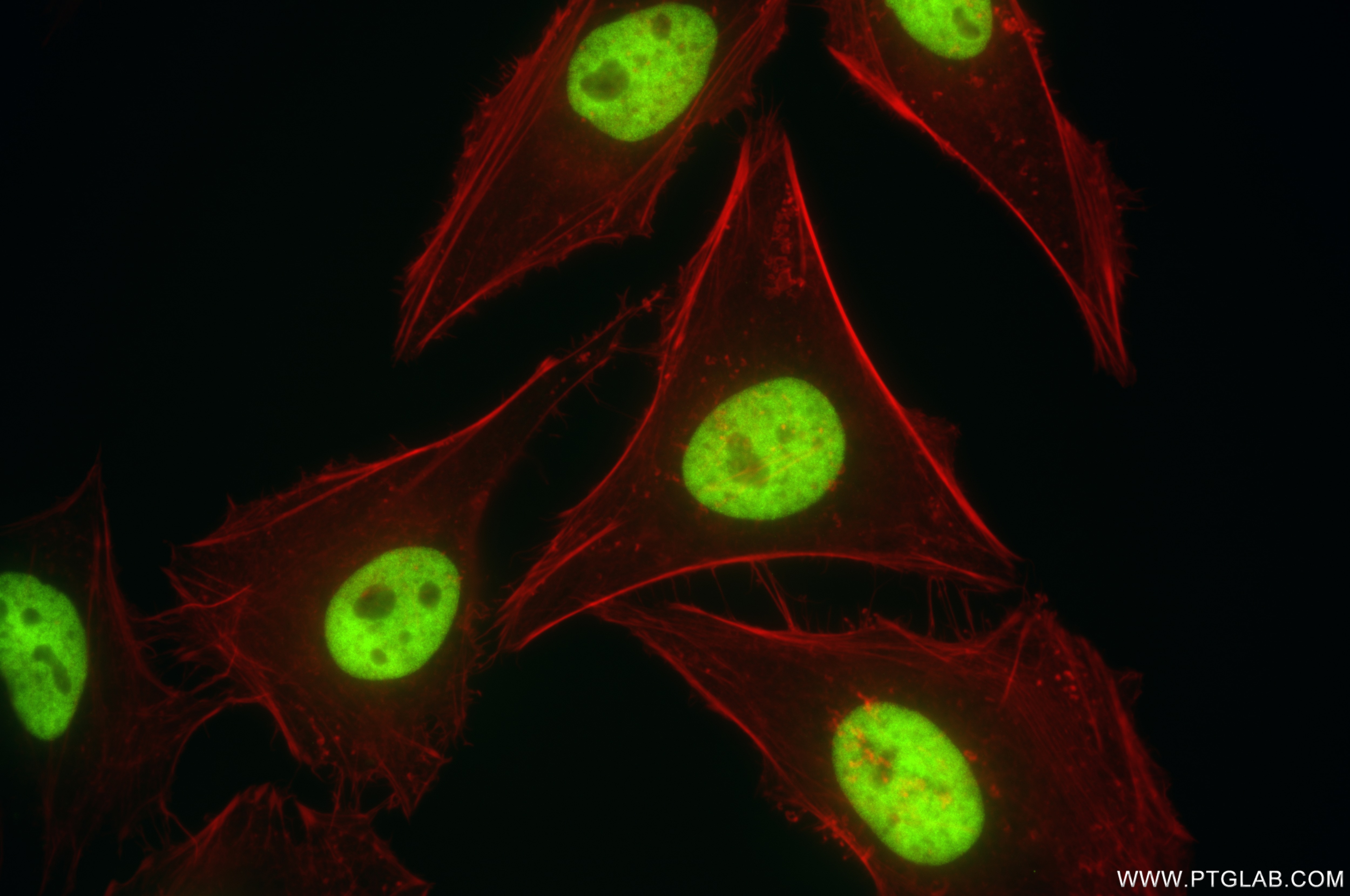 Immunofluorescence (IF) / fluorescent staining of HeLa cells using SMARCA5 Recombinant antibody (85019-3-RR)