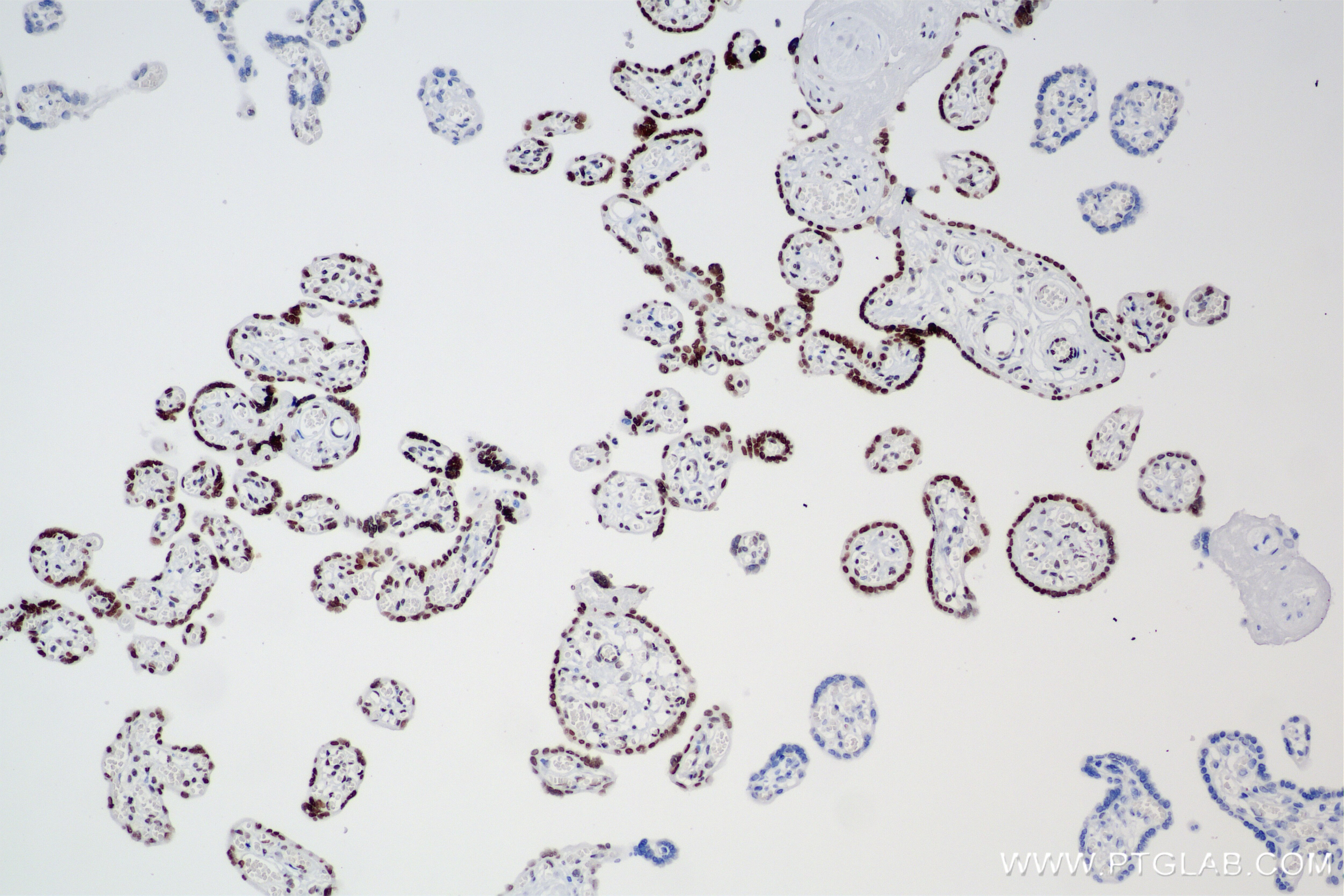Immunohistochemical analysis of paraffin-embedded human placenta tissue slide using 85019-3-RR (SMARCA5 antibody) at dilution of 1:500 (under 10x lens). Heat mediated antigen retrieval with Tris-EDTA buffer (pH 9.0). Immunohistochemistry (IHC) staining of human placenta tissue using SMARCA5 Recombinant antibody (85019-3-RR)